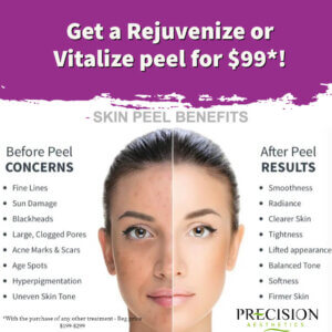 $99 skin peel offer with any other treatment!