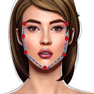 Diagram of areas of jawline treatable using Volux for women