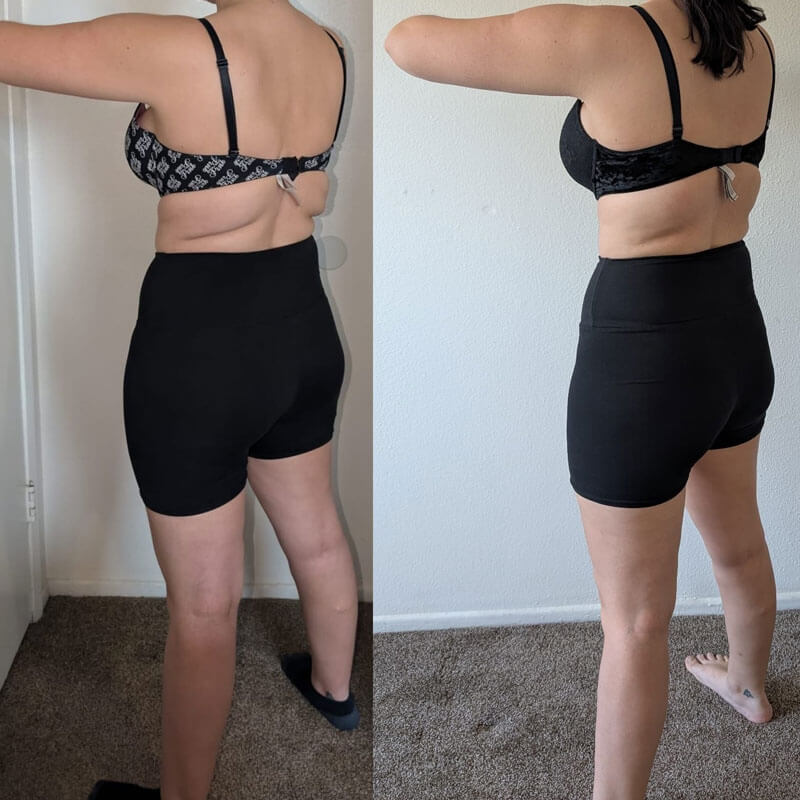 Semaglutide Before & After - Irvine, Orange County, CA