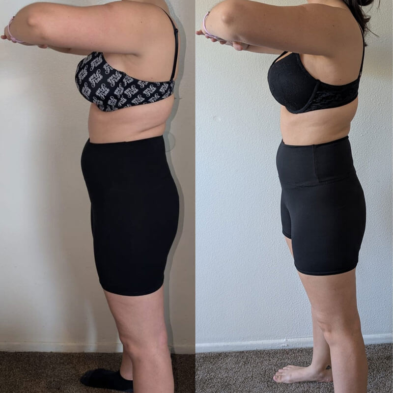 Semaglutide Before & After - Irvine, Orange County, CA