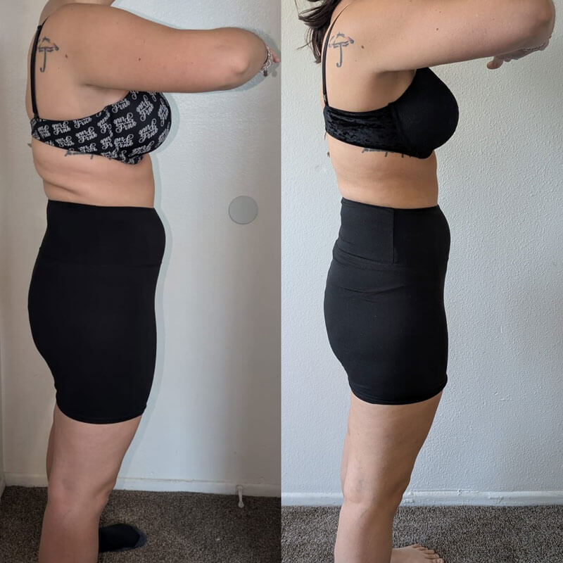 Semaglutide Before & After - Irvine, Orange County, CA