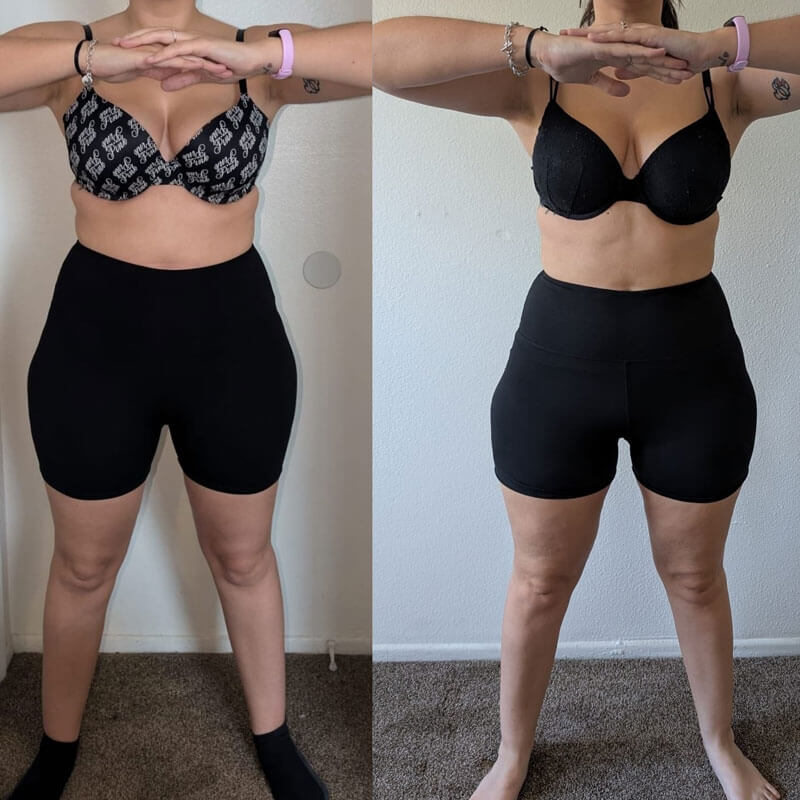 Semaglutide Before & After - Irvine, Orange County, CA