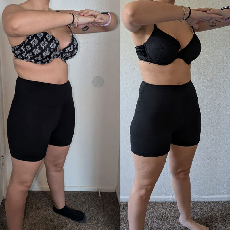 Semaglutide Before & After - Irvine, Orange County, CA