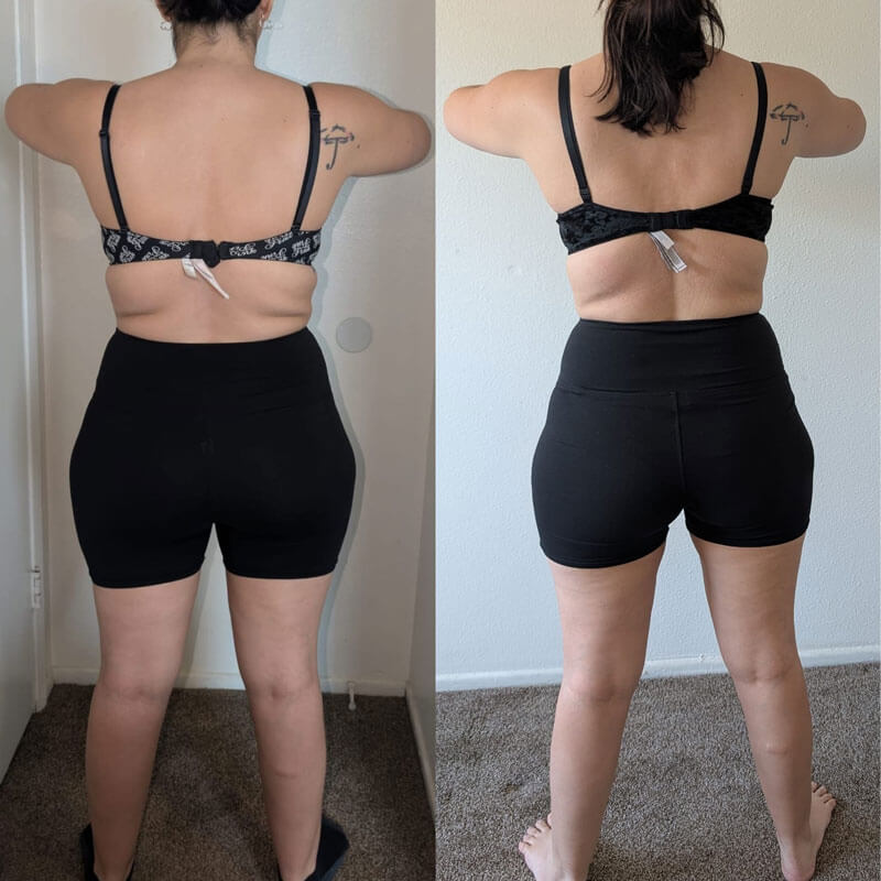 Semaglutide Before & After - Irvine, Orange County, CA